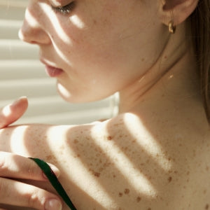 woman under shade touching her shoulder with sensitive skin and freckles